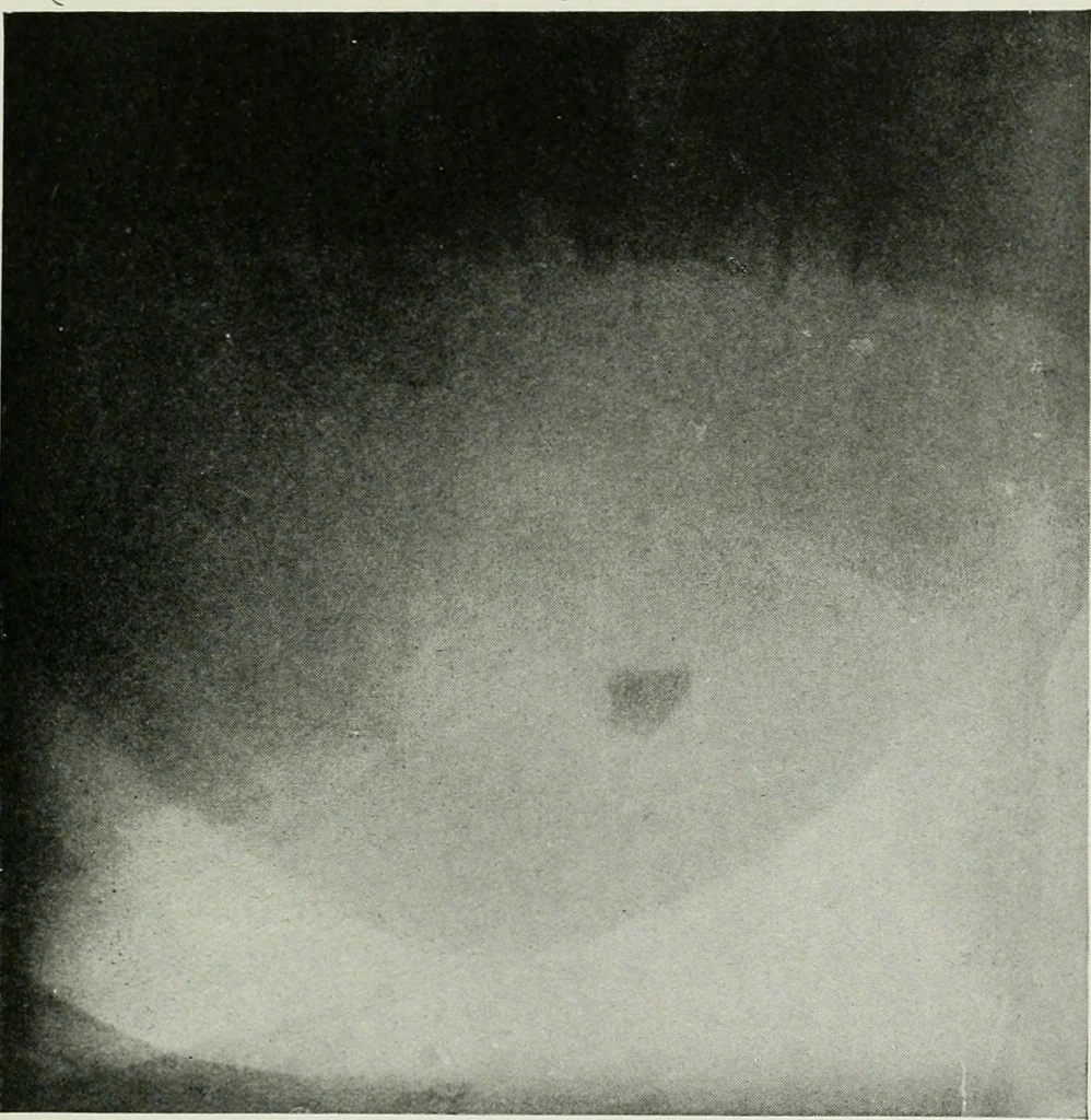 An illustration from X-rays, how to produce and interpret them, 1915, leaf 168