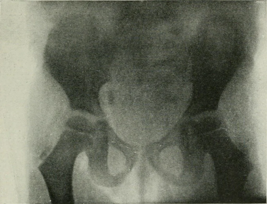 An illustration from X-rays, how to produce and interpret them, 1915, leaf 170