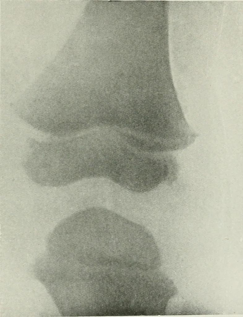 An illustration from X-rays, how to produce and interpret them, 1915, leaf 196