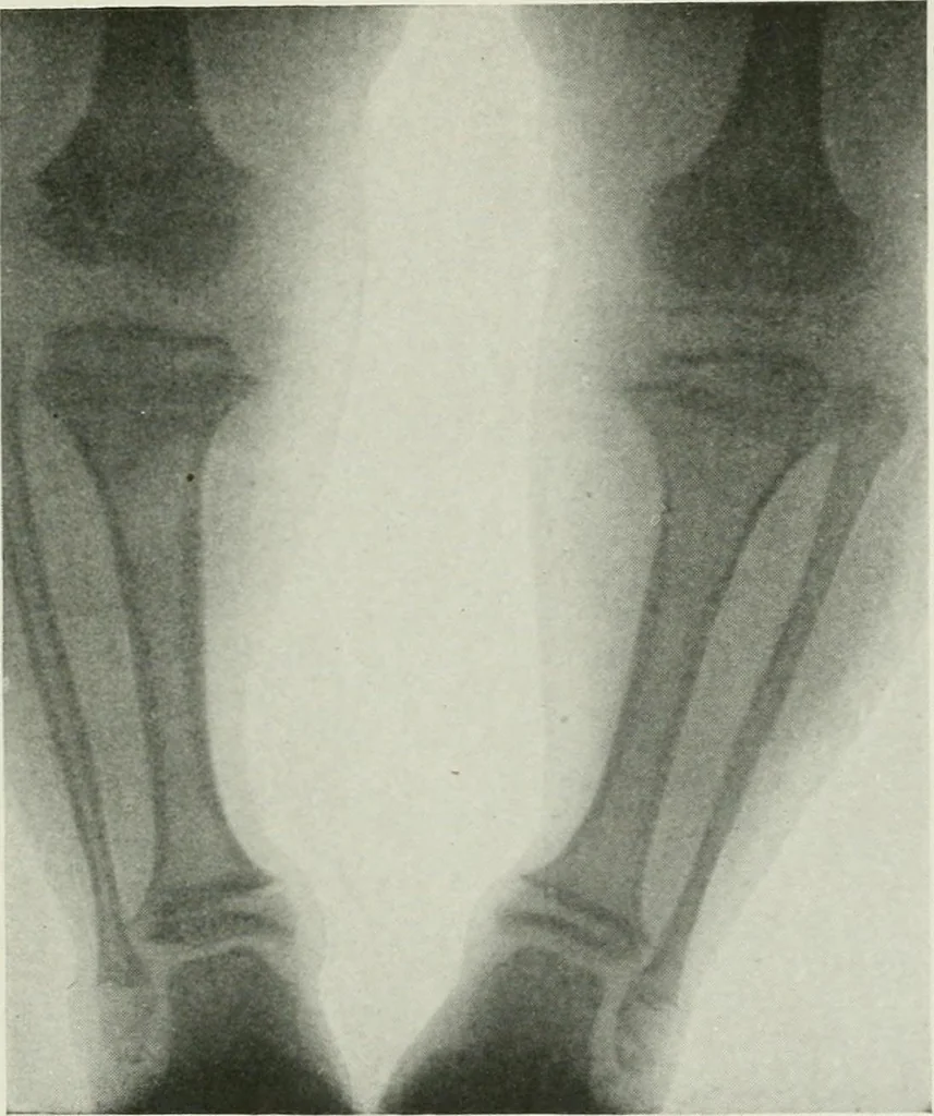 An illustration from X-rays, how to produce and interpret them, 1915, leaf 198