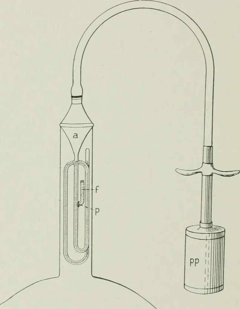 An illustration from X-rays, how to produce and interpret them, 1915, leaf 23