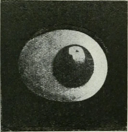 An illustration from X-rays, how to produce and interpret them, 1915, leaf 96