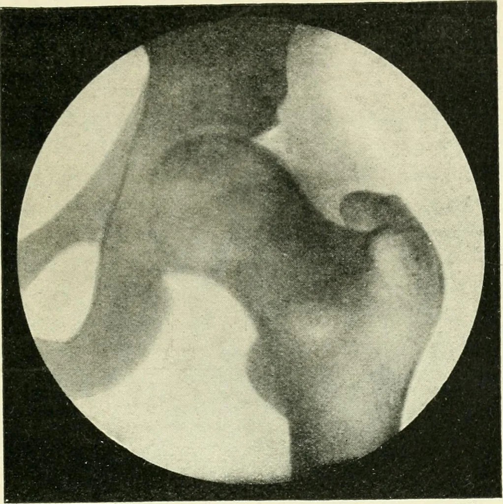 An illustration from X rays, an introduction to the study of Röntgen rays, 1914, leaf 178