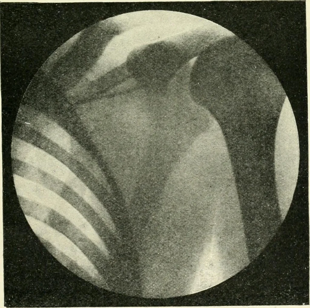 An illustration from X rays, an introduction to the study of Röntgen rays, 1914, leaf 178