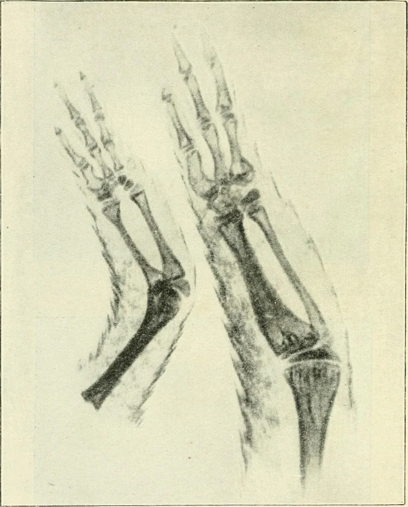 An illustration from X rays, an introduction to the study of Röntgen rays, 1914, leaf 179