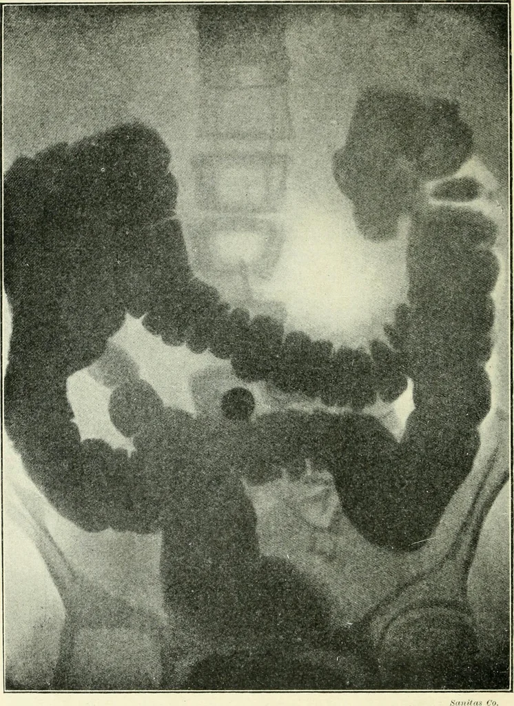 An illustration from X rays, an introduction to the study of Röntgen rays, 1914, leaf 181