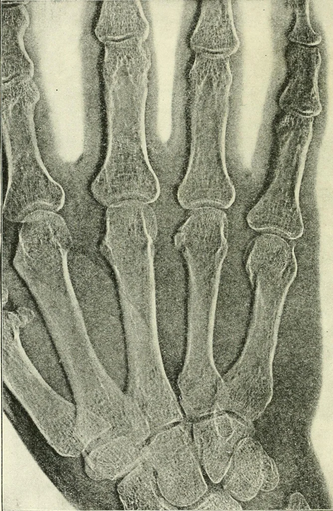 An illustration from X rays, an introduction to the study of Röntgen rays, 1914, leaf 185