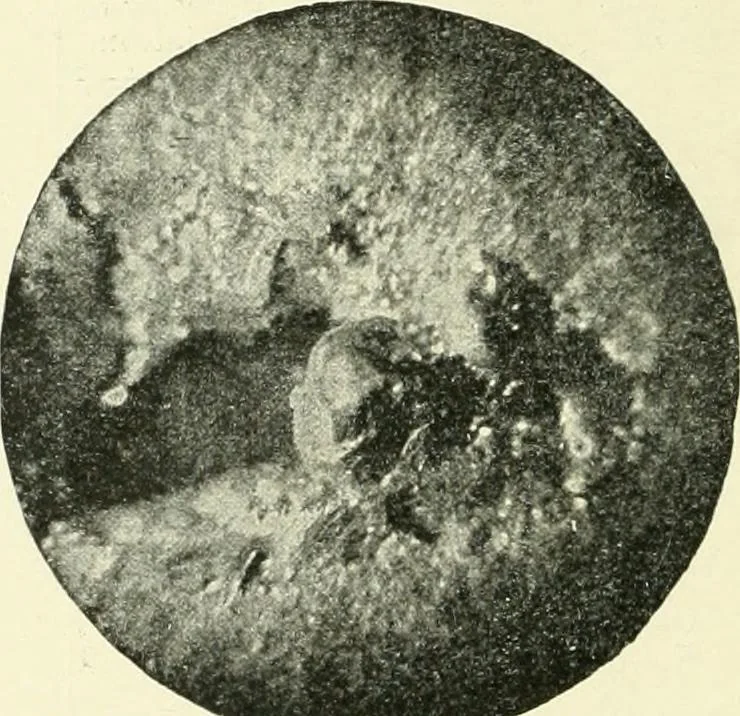 An illustration from X rays, an introduction to the study of Röntgen rays, 1914, leaf 63