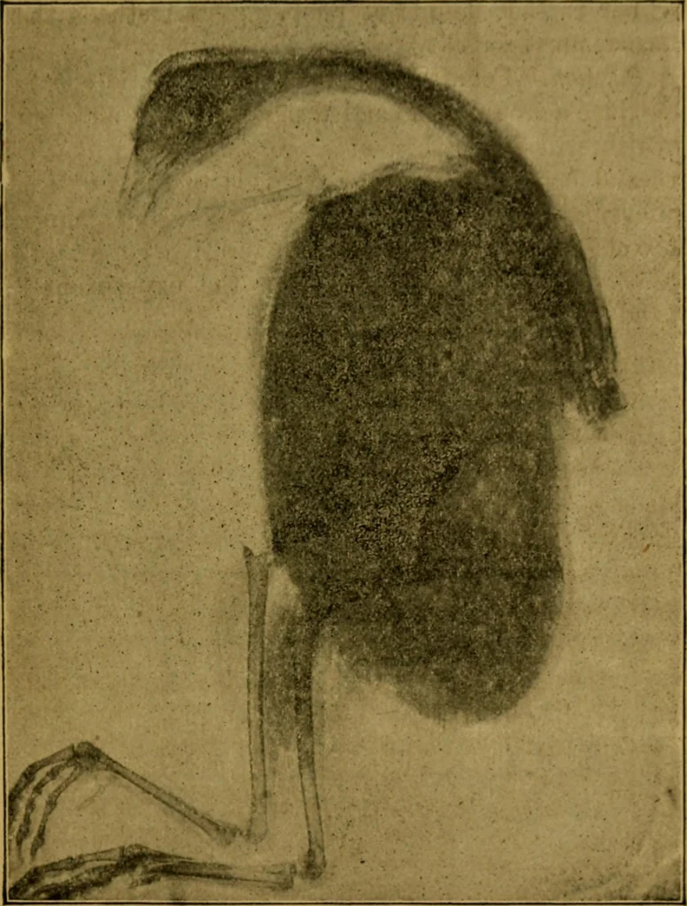 An illustration from X-rays simply explained : a handbook on the theory and practice of radiography, 1903, leaf 94