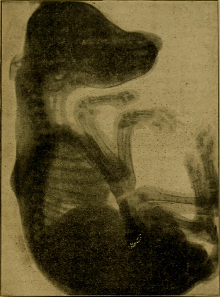 An illustration from X-rays simply explained : a handbook on the theory and practice of radiography, 1903, leaf 96