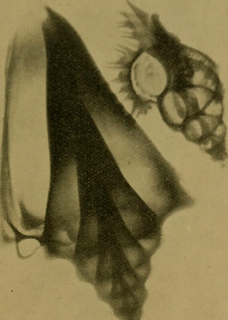 An illustration from X-rays simply explained : a handbook on Röntgen rays in theory and practice, 1904, leaf 110