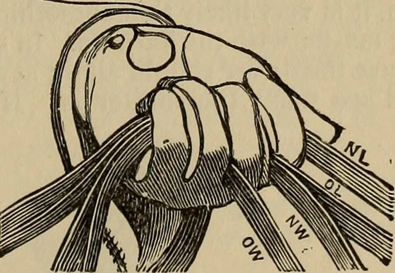 An illustration from The young folk's cyclopædia of games and sports ;, 1899, leaf 280