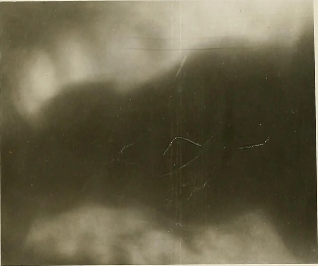 An illustration from Zehn Jahre Orthopädie und Röntgenologie 1896-1906, 1906, leaf 106