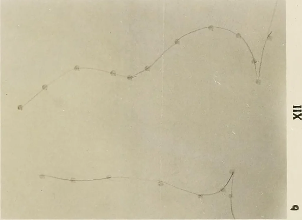 An illustration from Zehn Jahre Orthopädie und Röntgenologie 1896-1906, 1906, leaf 106