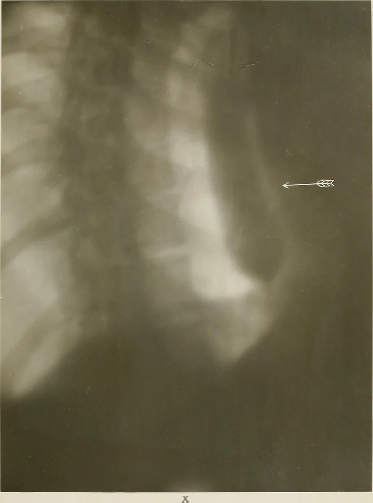 An illustration from Zehn Jahre Orthopädie und Röntgenologie 1896-1906, 1906, leaf 96