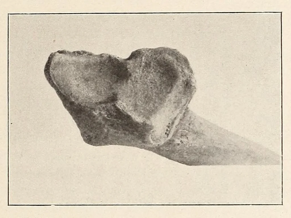 An illustration from Zur anthropologie des abflusslosen rumpfschollenlandes im nordöstlichen Deutsch-Ostrafrika, auf grund der sammlung der Ostrafrika- expedition (dr. E. Obst) der Geographischen gesellschaft in Hamburg, 1915, leaf 211