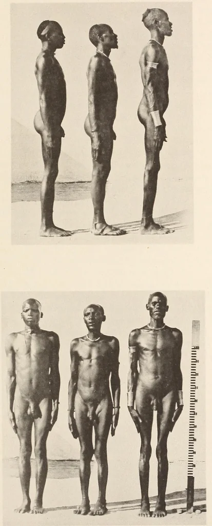 An illustration from Zur anthropologie des abflusslosen rumpfschollenlandes im nordöstlichen Deutsch-Ostrafrika, auf grund der sammlung der Ostrafrika- expedition (dr. E. Obst) der Geographischen gesellschaft in Hamburg, 1915, leaf 233
