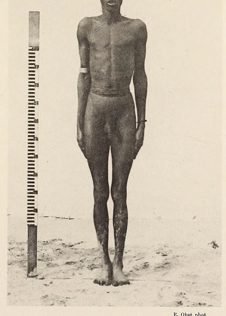 An illustration from Zur anthropologie des abflusslosen rumpfschollenlandes im nordöstlichen Deutsch-Ostrafrika, auf grund der sammlung der Ostrafrika- expedition (dr. E. Obst) der Geographischen gesellschaft in Hamburg, 1915, leaf 241