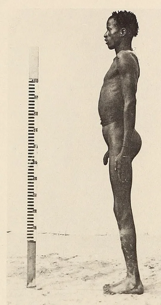 An illustration from Zur anthropologie des abflusslosen rumpfschollenlandes im nordöstlichen Deutsch-Ostrafrika, auf grund der sammlung der Ostrafrika- expedition (dr. E. Obst) der Geographischen gesellschaft in Hamburg, 1915, leaf 241