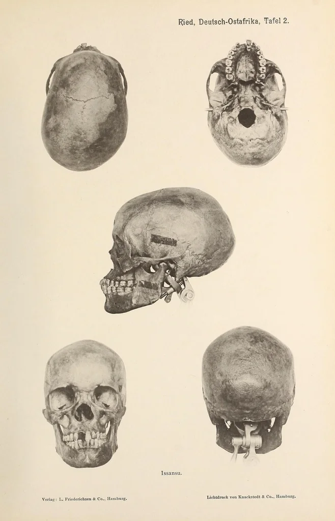 An illustration from Zur anthropologie des abflusslosen rumpfschollenlandes im nordöstlichen Deutsch-Ostrafrika, auf grund der sammlung der Ostrafrika- expedition (dr. E. Obst) der Geographischen gesellschaft in Hamburg, 1915, leaf 41