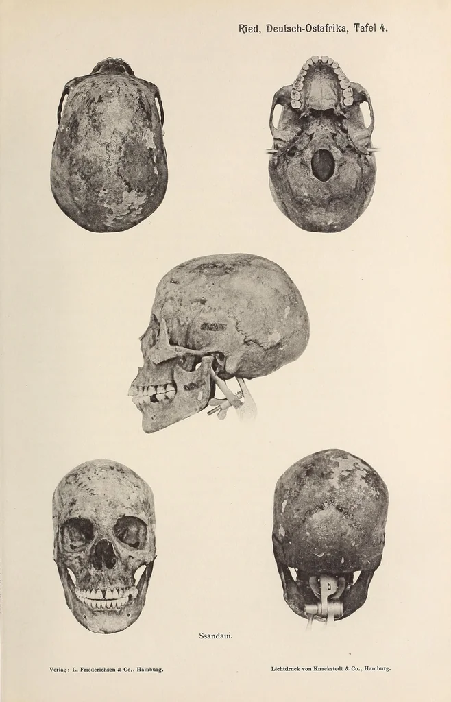 An illustration from Zur anthropologie des abflusslosen rumpfschollenlandes im nordöstlichen Deutsch-Ostrafrika, auf grund der sammlung der Ostrafrika- expedition (dr. E. Obst) der Geographischen gesellschaft in Hamburg, 1915, leaf 75