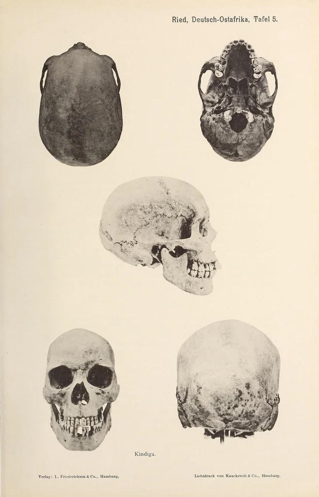 An illustration from Zur anthropologie des abflusslosen rumpfschollenlandes im nordöstlichen Deutsch-Ostrafrika, auf grund der sammlung der Ostrafrika- expedition (dr. E. Obst) der Geographischen gesellschaft in Hamburg, 1915, leaf 89
