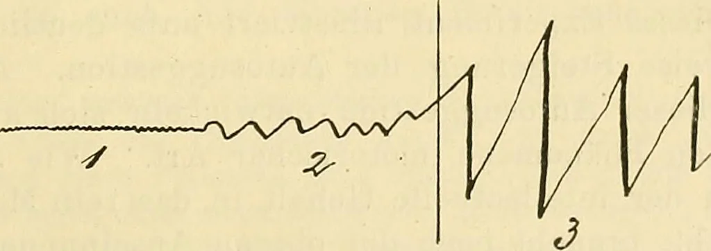 An illustration from Zur Psychologie und Pathologie sogenannter occulter Phänomene : eine psychiatrische Studie, 1902, leaf 74