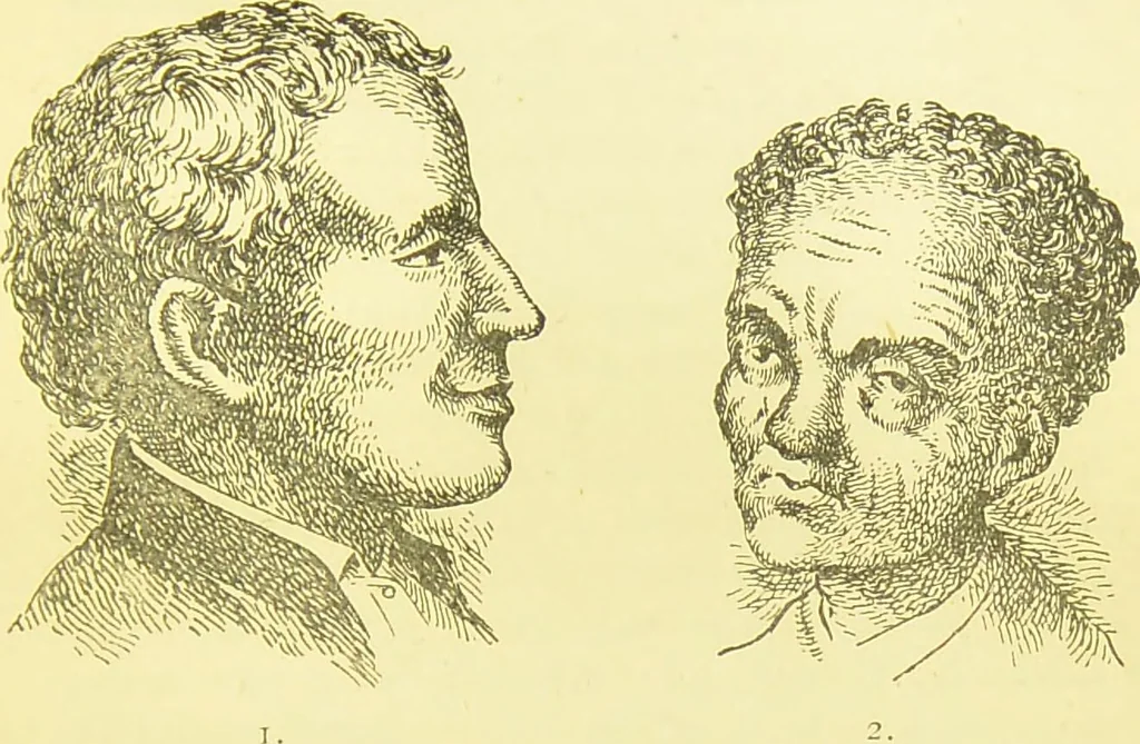 An illustration from The criminal / by Havelock Ellis., 1895, leaf 177