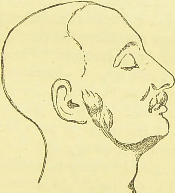 An illustration from The criminal / by Havelock Ellis., 1895, leaf 317