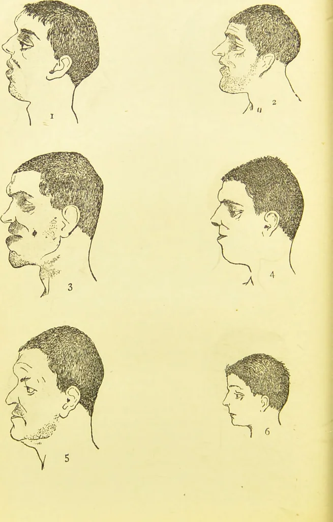 An illustration from The criminal / by Havelock Ellis., 1895, leaf 74