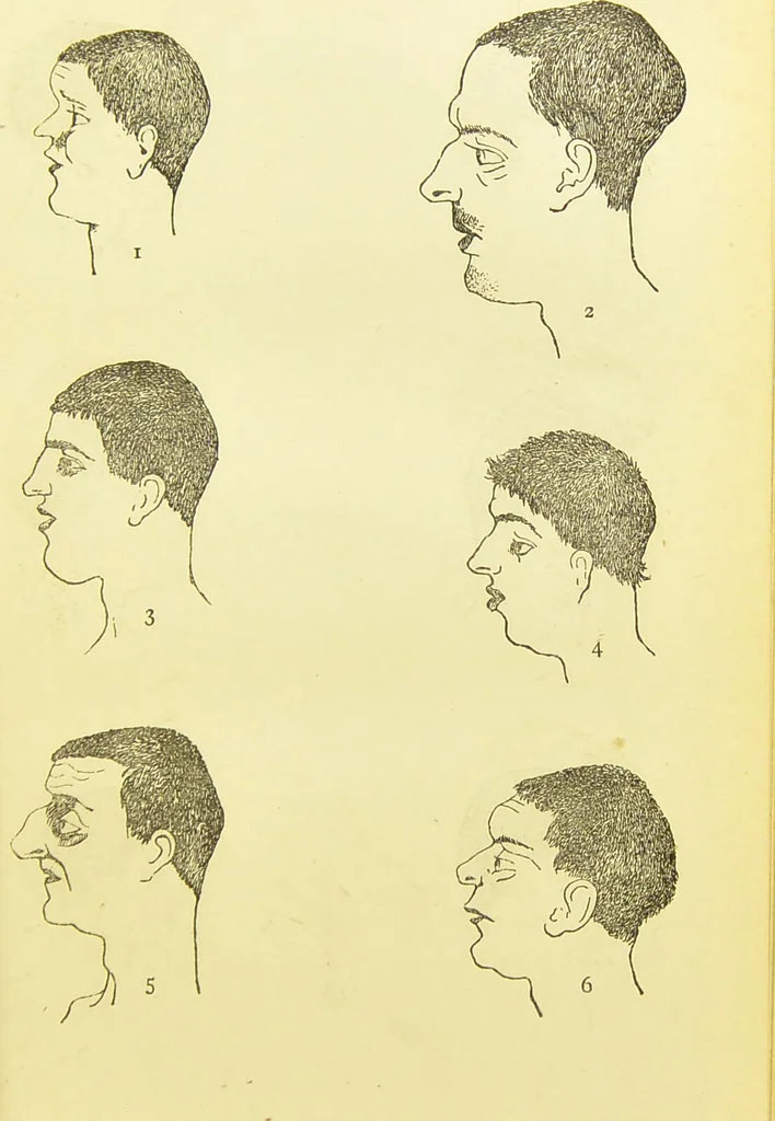 An illustration from The criminal / by Havelock Ellis., 1895, leaf 75