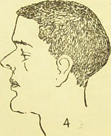 An illustration from The criminal / by Havelock Ellis., 1895, leaf 77