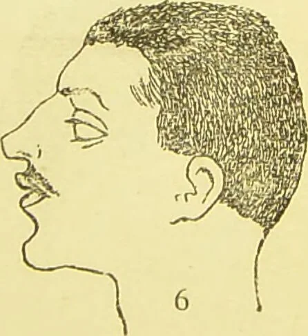 An illustration from The criminal / by Havelock Ellis., 1895, leaf 77