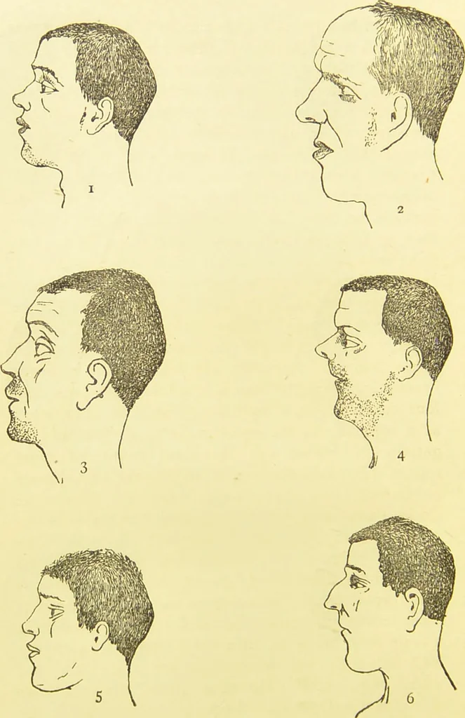 An illustration from The criminal / by Havelock Ellis., 1895, leaf 78