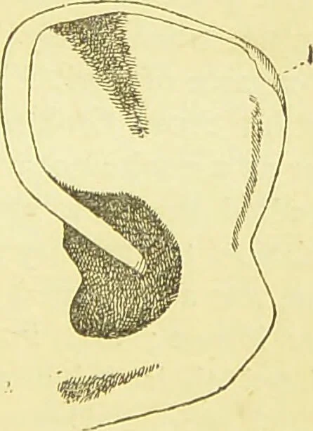 An illustration from The criminal / by Havelock Ellis., 1895, leaf 83