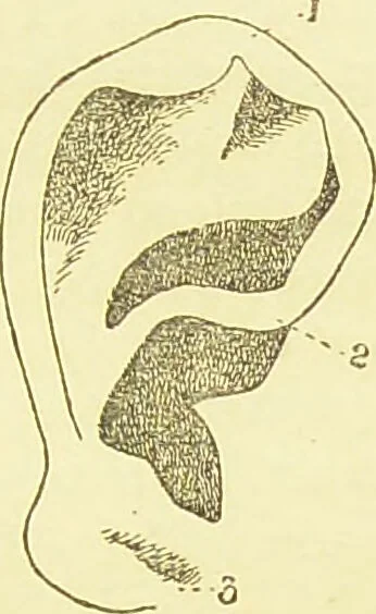 An illustration from The criminal / by Havelock Ellis., 1895, leaf 85