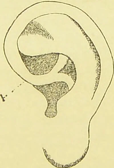 An illustration from The criminal / by Havelock Ellis., 1895, leaf 87