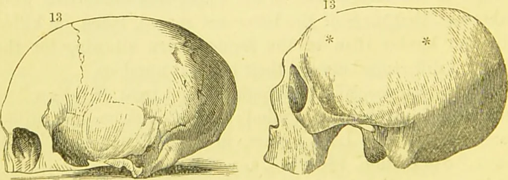 An illustration from Elements of phrenology / by George Combe., 1873, leaf 104