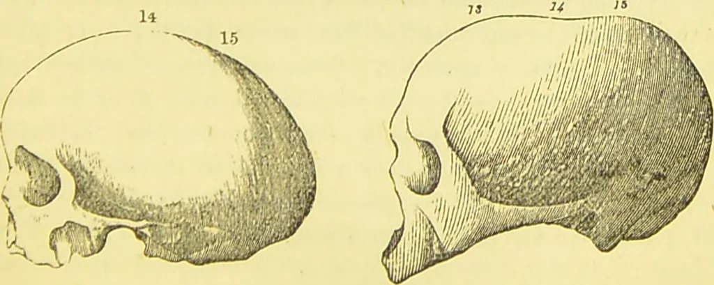 An illustration from Elements of phrenology / by George Combe., 1873, leaf 107