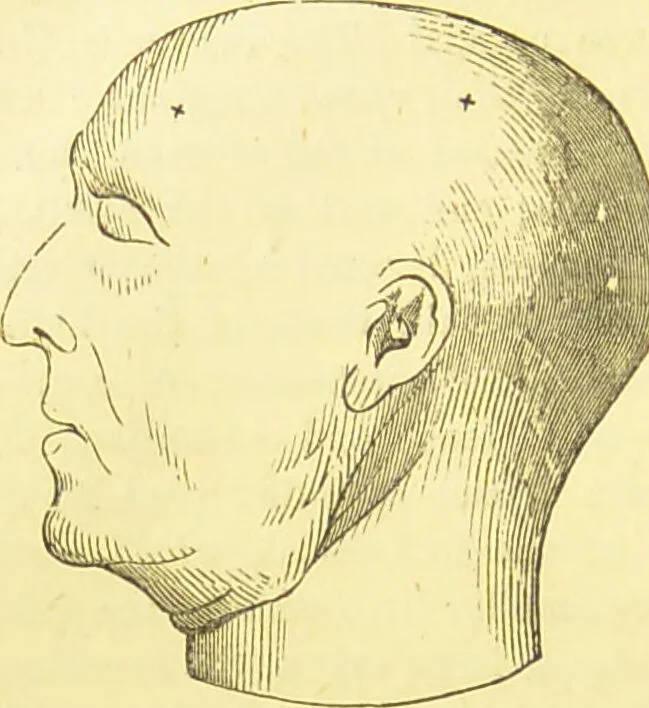 An illustration from Elements of phrenology / by George Combe., 1873, leaf 206