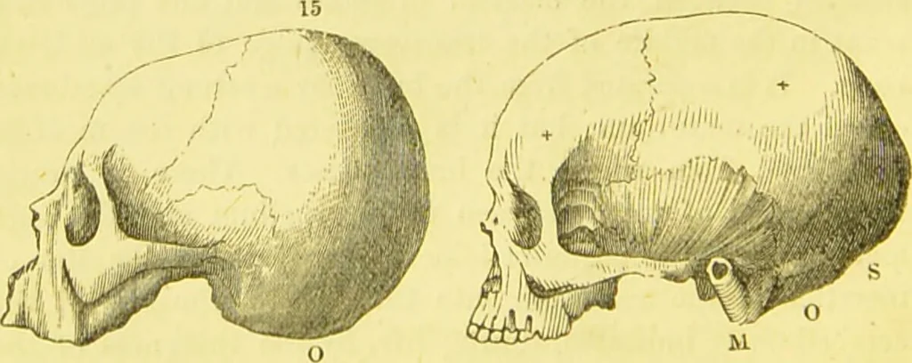 An illustration from Elements of phrenology / by George Combe., 1873, leaf 74