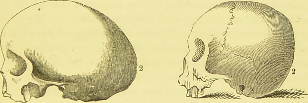 An illustration from Elements of phrenology / by George Combe., 1873, leaf 77