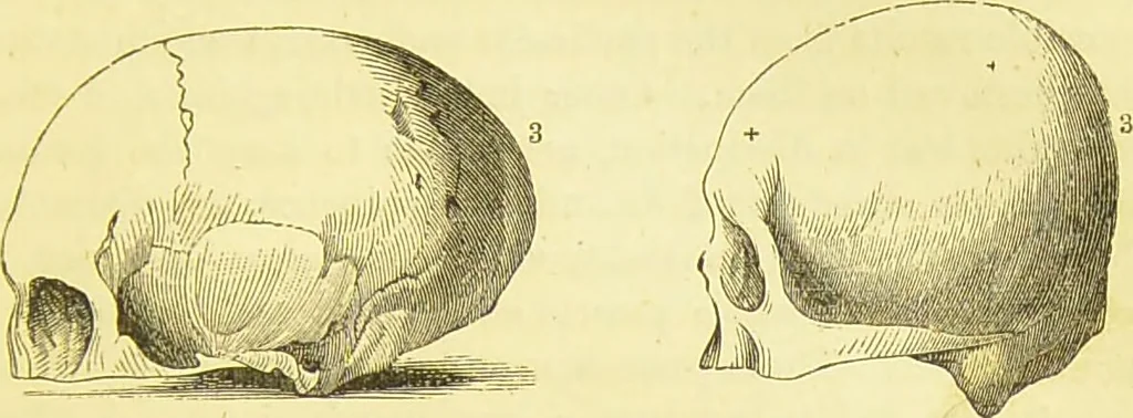 An illustration from Elements of phrenology / by George Combe., 1873, leaf 79