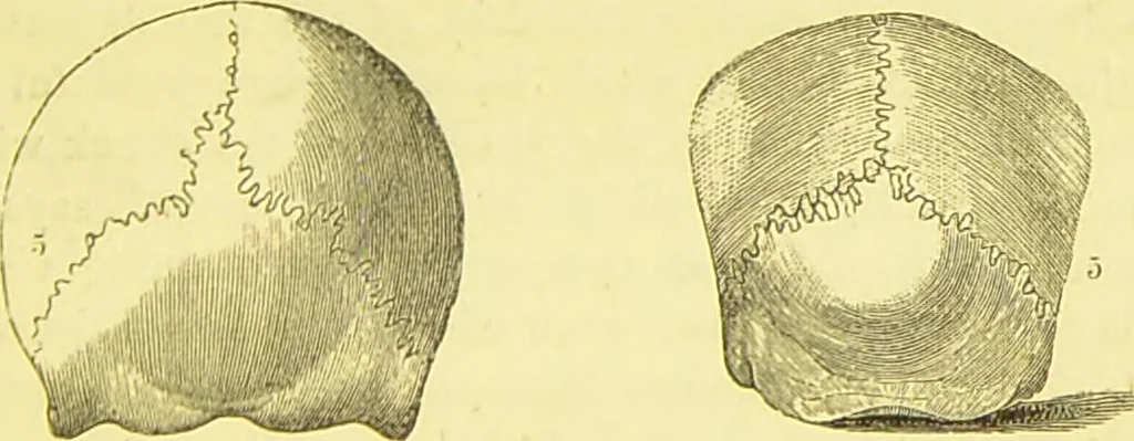 An illustration from Elements of phrenology / by George Combe., 1873, leaf 83