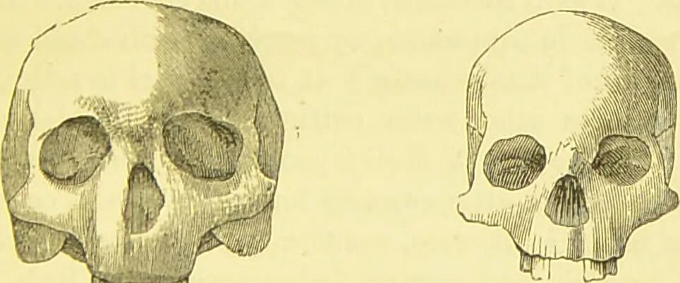 An illustration from Elements of phrenology / by George Combe., 1873, leaf 85