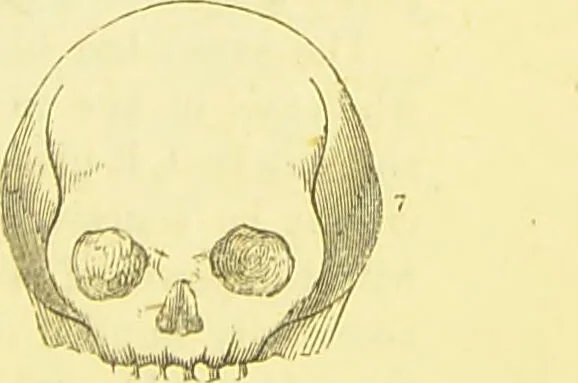 An illustration from Elements of phrenology / by George Combe., 1873, leaf 89