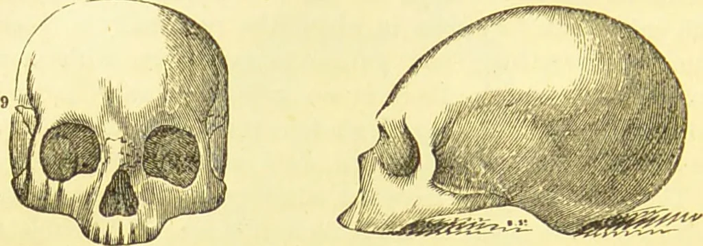 An illustration from Elements of phrenology / by George Combe., 1873, leaf 94