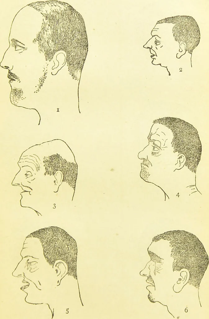 An illustration from The criminal / by Havelock Ellis., 1890, leaf 67
