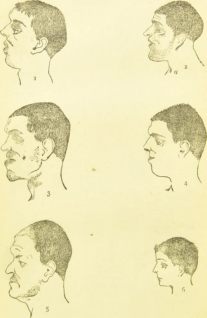 An illustration from The criminal / by Havelock Ellis., 1890, leaf 68