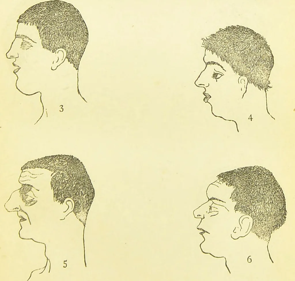 An illustration from The criminal / by Havelock Ellis., 1890, leaf 69